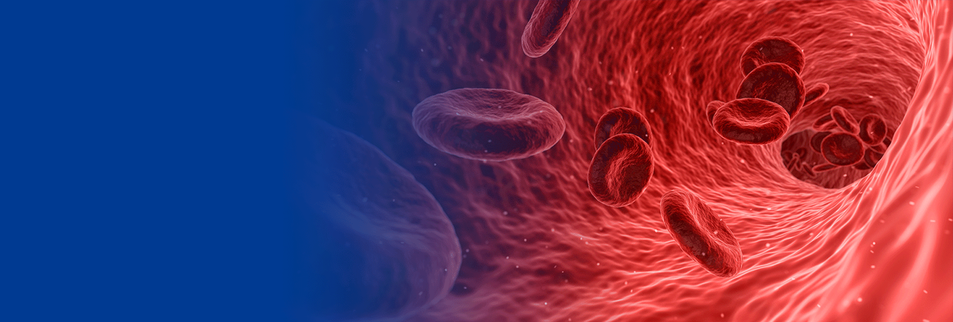 Arteriovenous Access_Easy-Flow Medtech